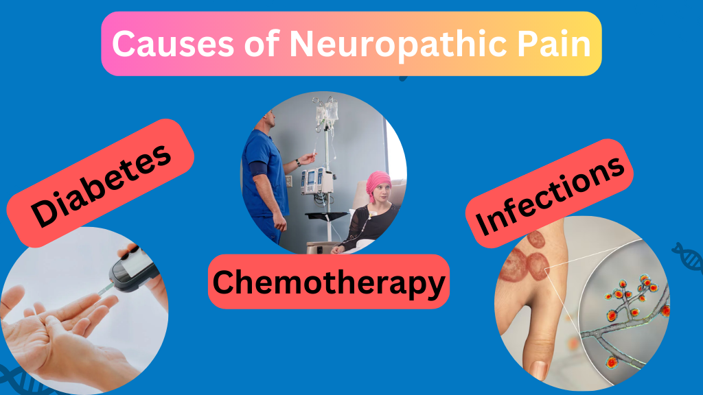 Causes of Neuropathic Pain