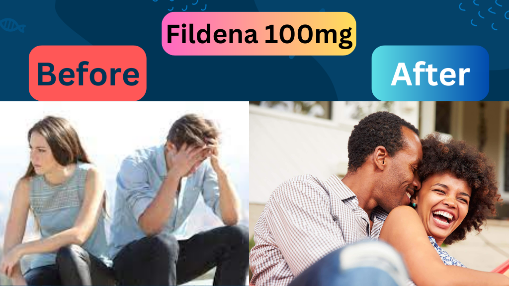 Fildena-100mg-uses