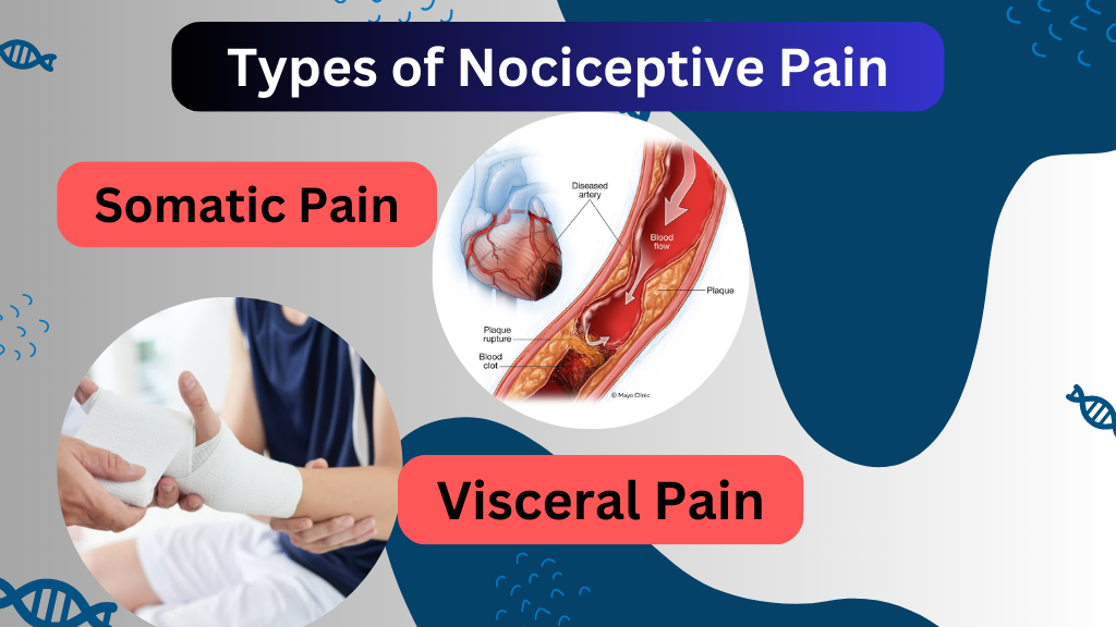 Types of Nociceptive Pain